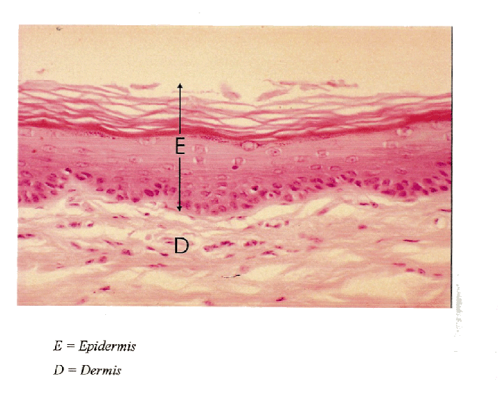 Micrograph of Skin of the Abdomen