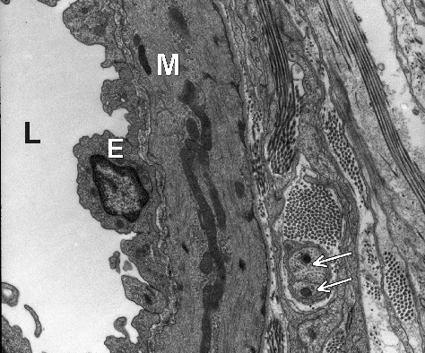 Micrograph of Arteriole