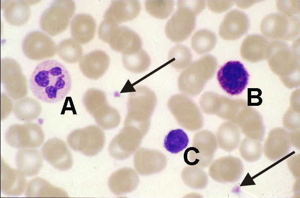 Platelets - 2