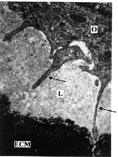 Electron Micrograph of Bone