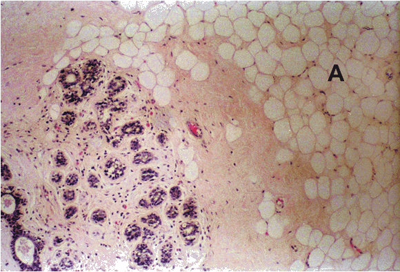 Micrograph of Inactive Breast