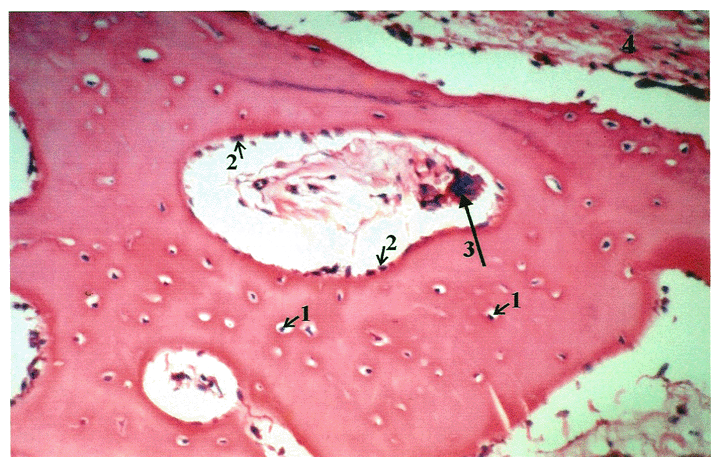 Micrograph of Cancellous Bone