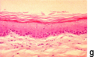 Micrograph G