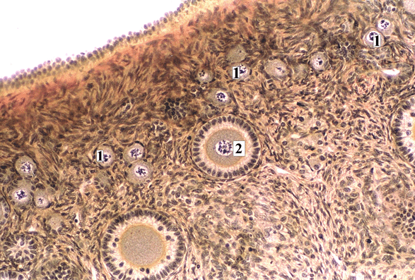 Micrograph of Primordial and Primary Ovarian Follicles