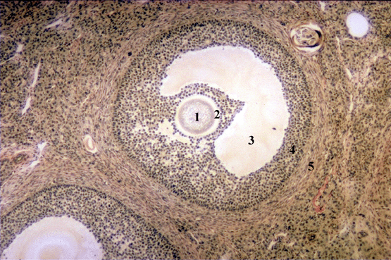 Micrograph of Graafian Follicles