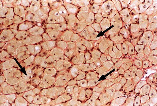 Micrograph of Corpus Luteum