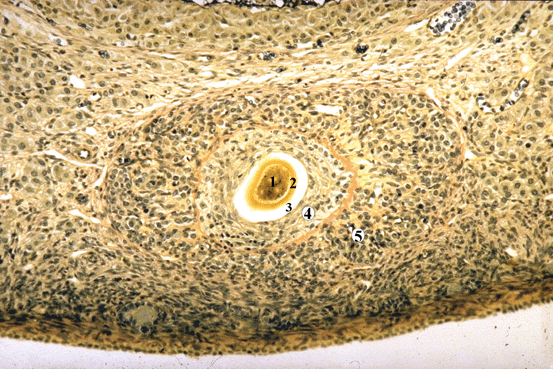 Micrograph of Atretic Follicle