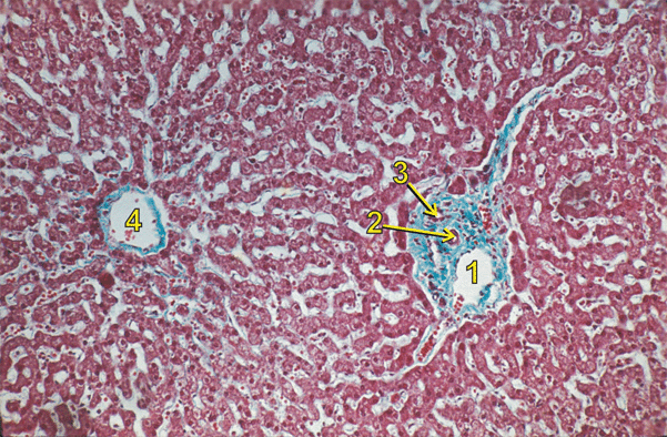 Liver Micrograph