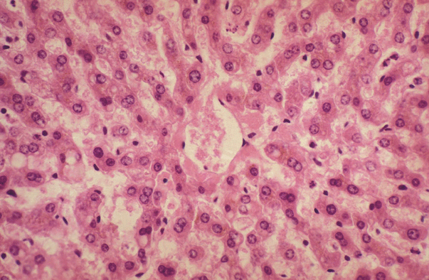 Liver Micrograph