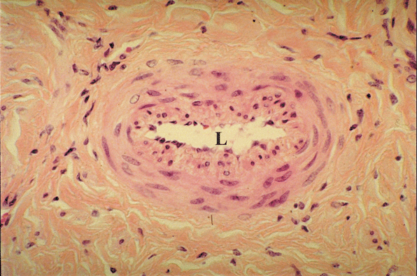 Helicine Artery of Penis