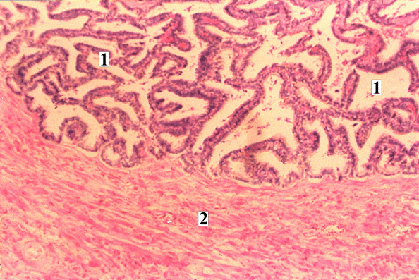 Micrograph of Ductus Deferens