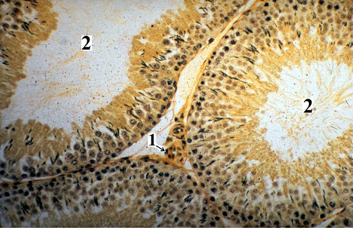 Micrograph of Seminiferous Tubules