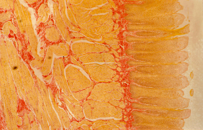 Micrograph of Tongue Dorsal Surface Epithelium
