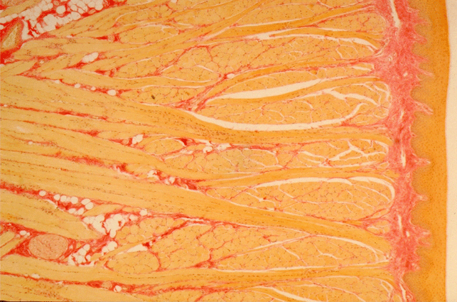 Micrograph of Tongue Ventral Surface Epithelium
