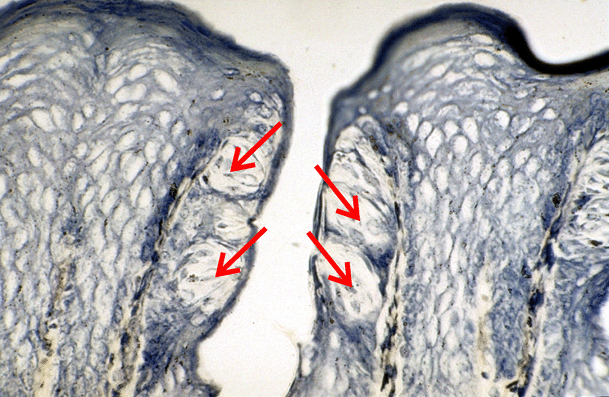 Micrograph of Taste Buds