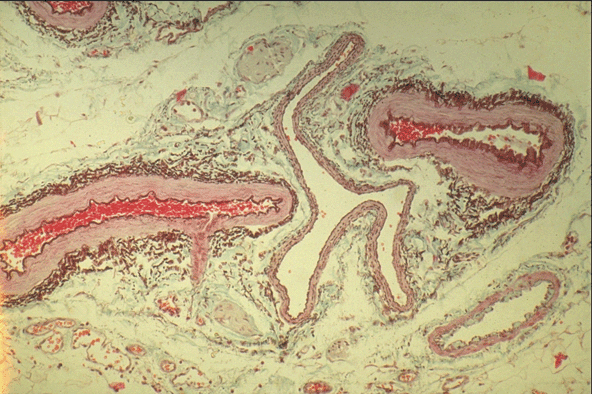 Micrograph of Peripheral Vein