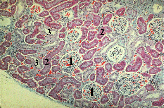 Micrograph of Filtration Barrier