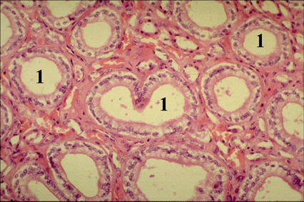Micrograph of Kidney Medulla