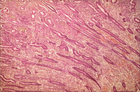 Uterine Wall - Late Proliferative Phase