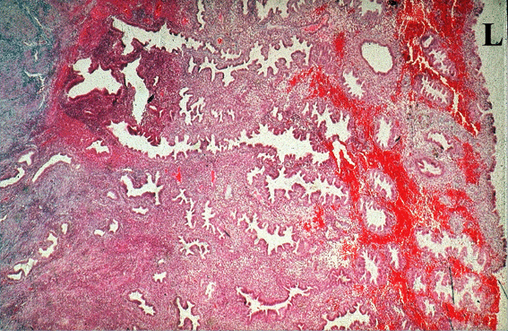 Micrograph of Uterine Tube