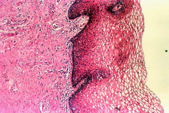 Micrograph of Vagina