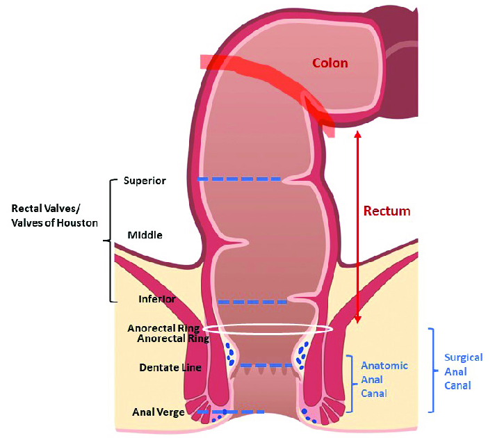 Rectal Prolapse