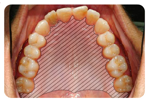 The Oral Cavity
